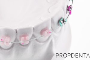 Ortodoncia para Niños en Galapagar Madrid España