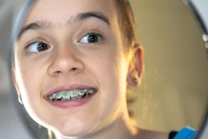 Ortodoncia para Niños en Cercedilla, Madrid: Soluciones Dentales Especializadas